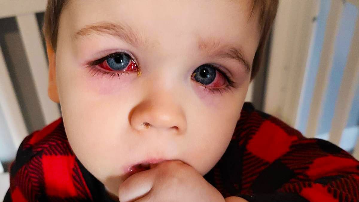 Ces jouets adorés des enfants sont dangereux pour leurs yeux, l’Anses lance l’alerte